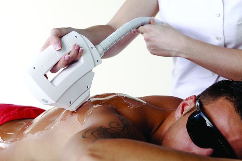 Epilation-homme